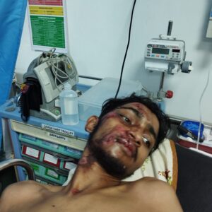 Let’s Save 17-Year-Old Debarshi